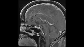 BRAIN
