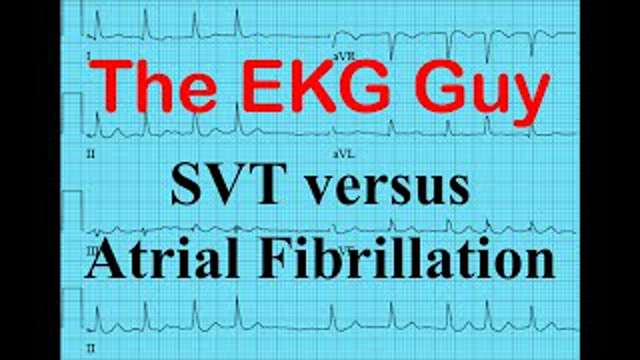EKG/ECG - SVT vs Atrial Fibrillation | The EKG Guy - www.EKG.md